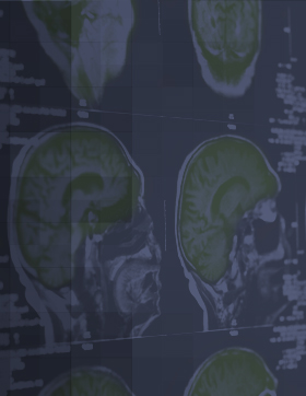 bg-ad-amnestic-mild-cognitive-impairment-publications