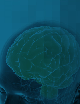 bg-ad-amnestic-mild-cognitive-impairment